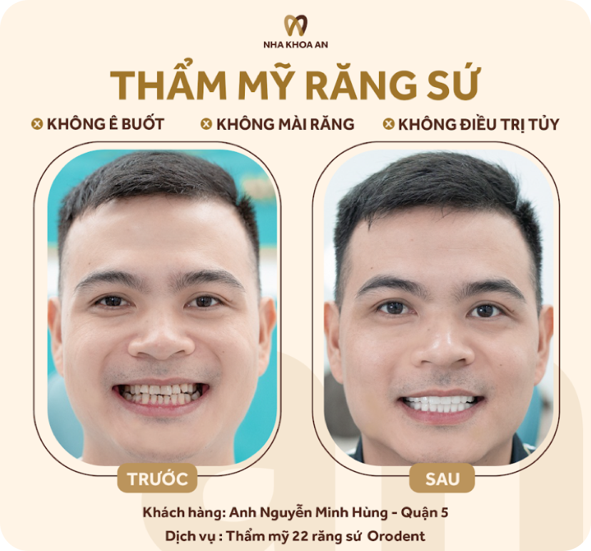 thammy-2