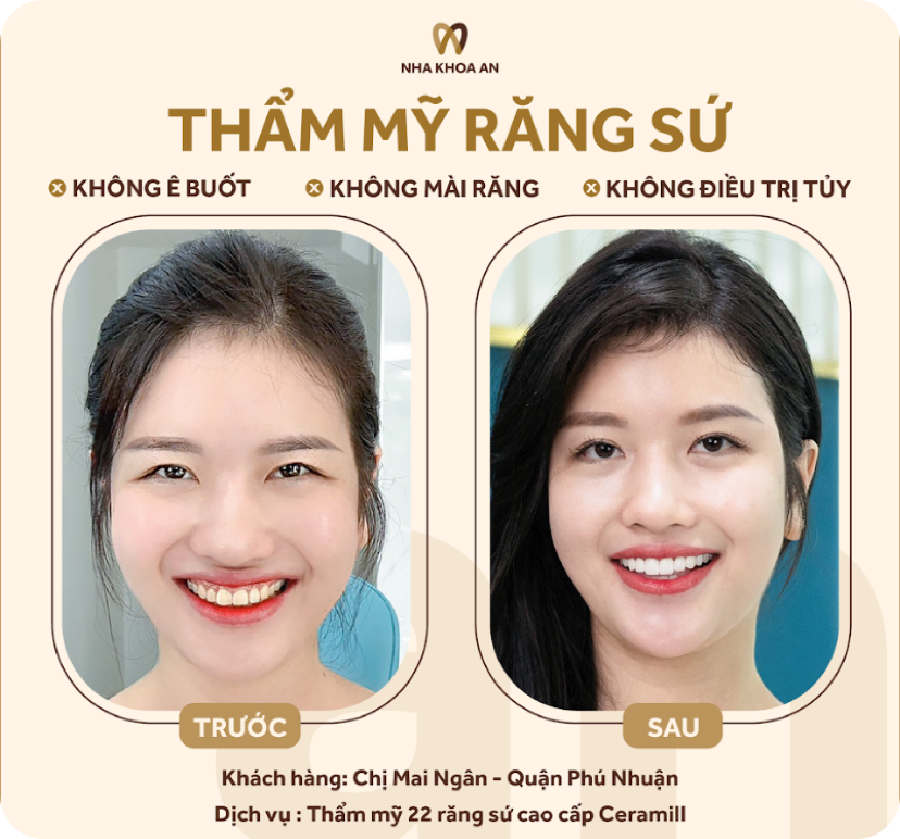 thammy-3