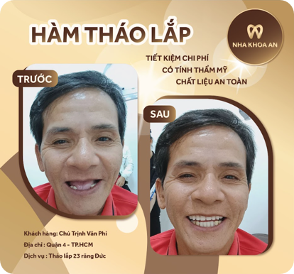 ham-1