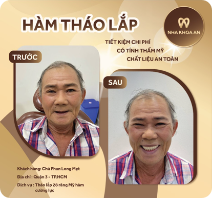 ham-2