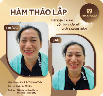 ham-3