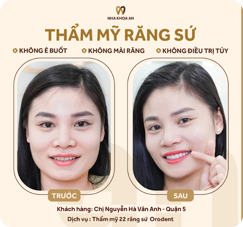 thammy-5